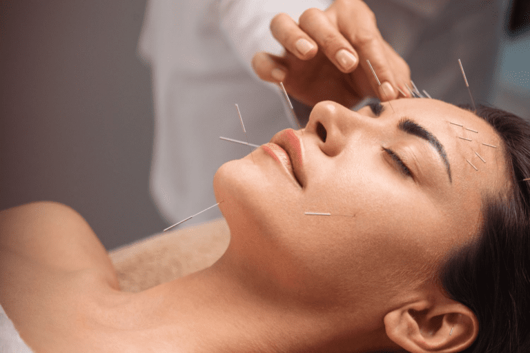 Most-Powerful-Acupuncture