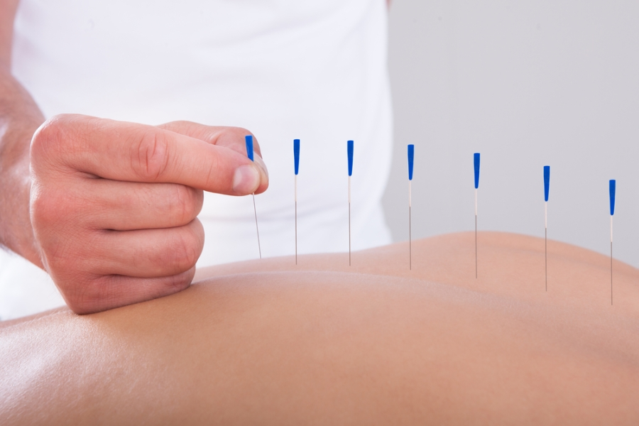 How-Acupuncture-Aids