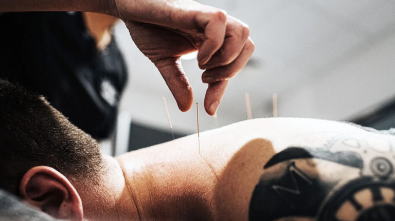 Mastering-Acupuncture-Frequency