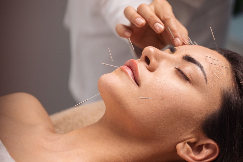 Most-Powerful-Acupuncture