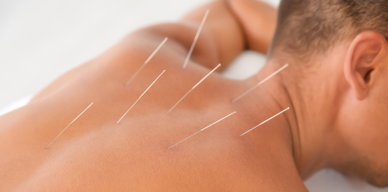 Most-Powerful-Acupuncture-222