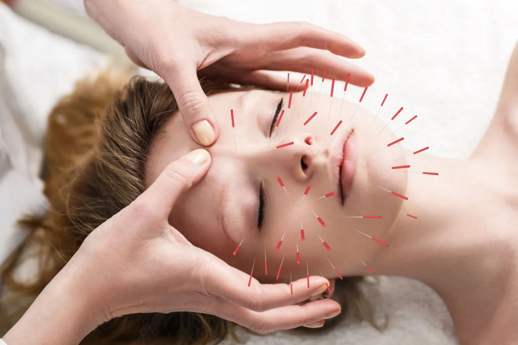 Mysteries-of-Acupuncture