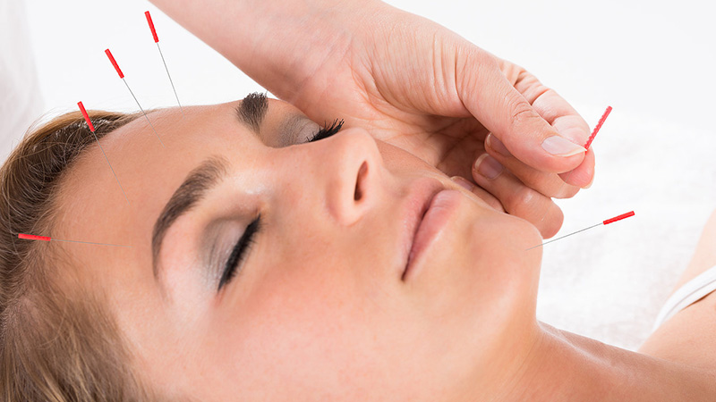 Norma-Side-Effect-of-Acupuncture-111