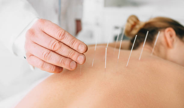 Norma-Side-Effect-of-Acupuncture-222