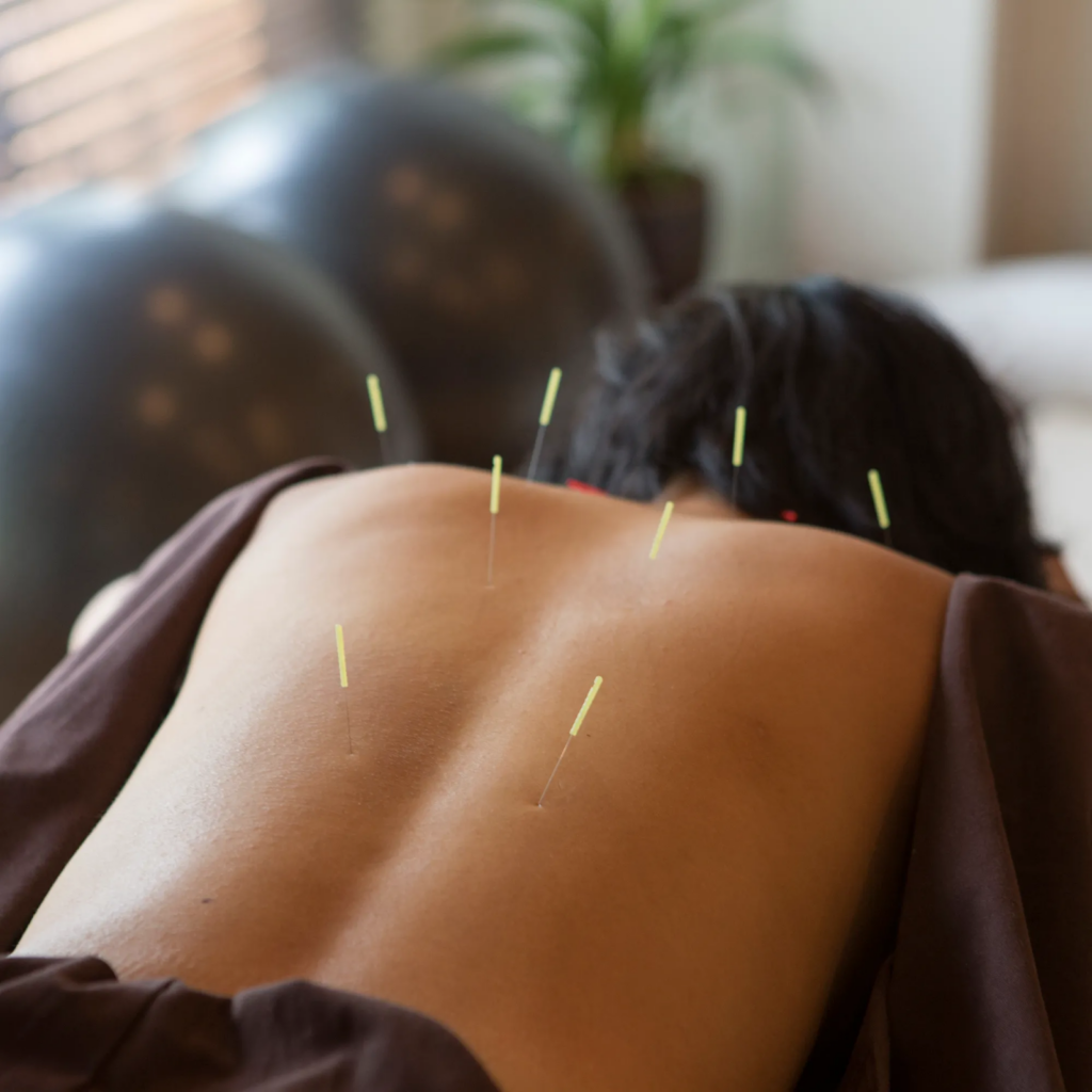 Acupuncture-Be-Avoided