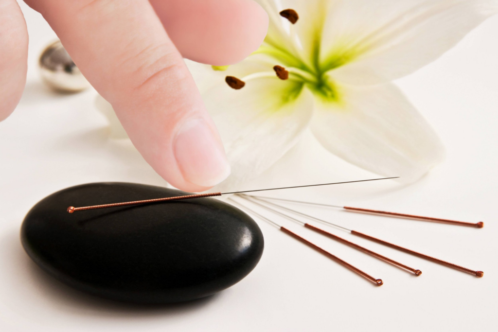 Acupuncturist