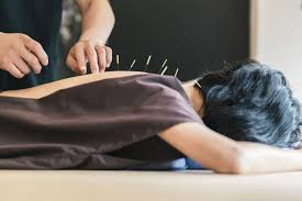 Benefit-from-Acupuncture