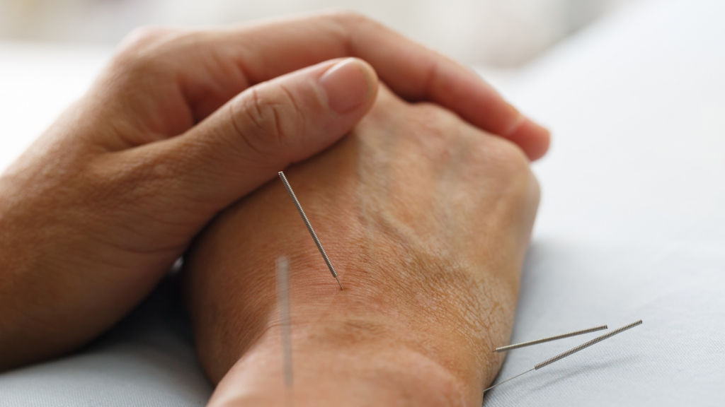 Costs-of-Acupuncture