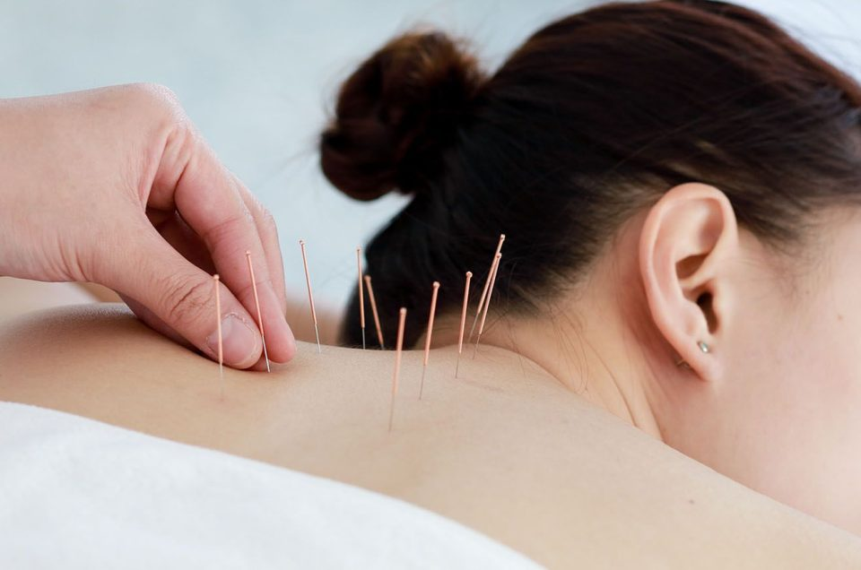 Costs-of-Acupuncture