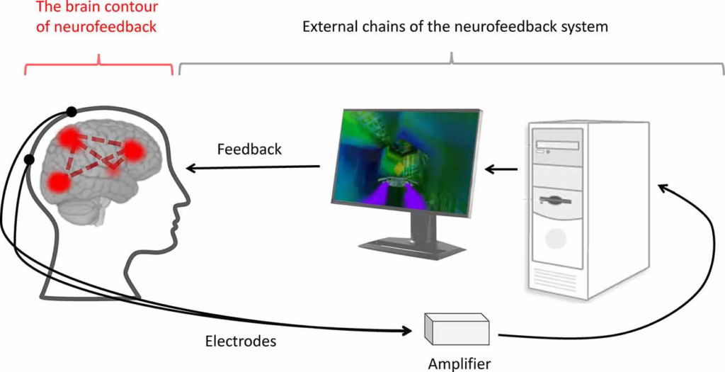 EMDR