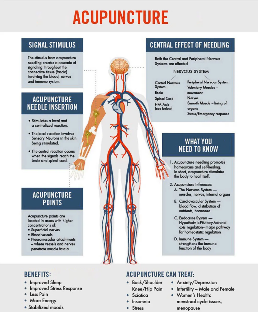 Power-of-Acupuncture